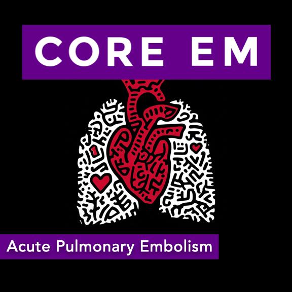 https://coreem.net/content/uploads/2025/10/Acute-Pulmonary-Embolism.001-1.jpeg