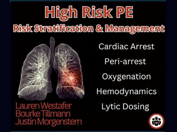 https://emergencymedicinecases.com/wp-content/uploads/2025/04/High-Risk-PE-CARD.jpg