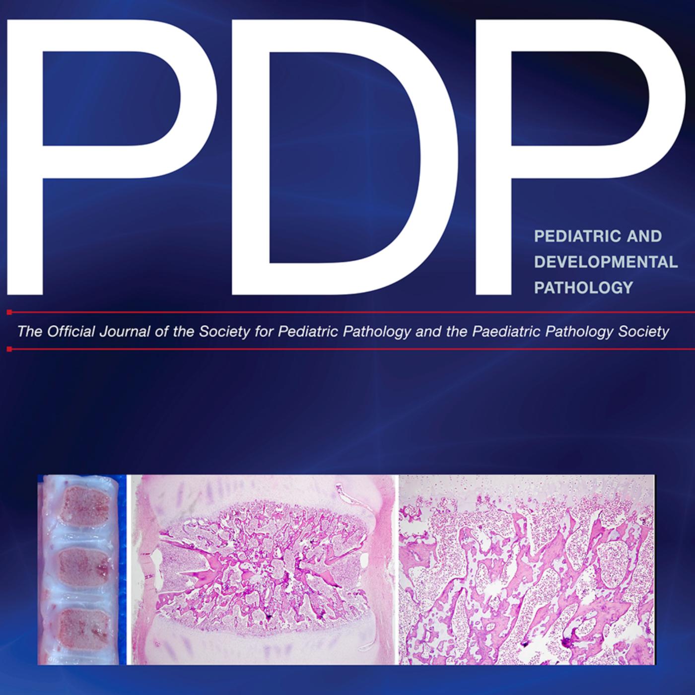 https://pbcdn1.podbean.com/imglogo/ep-logo/pbblog15902954/PDPs2cover.jpg