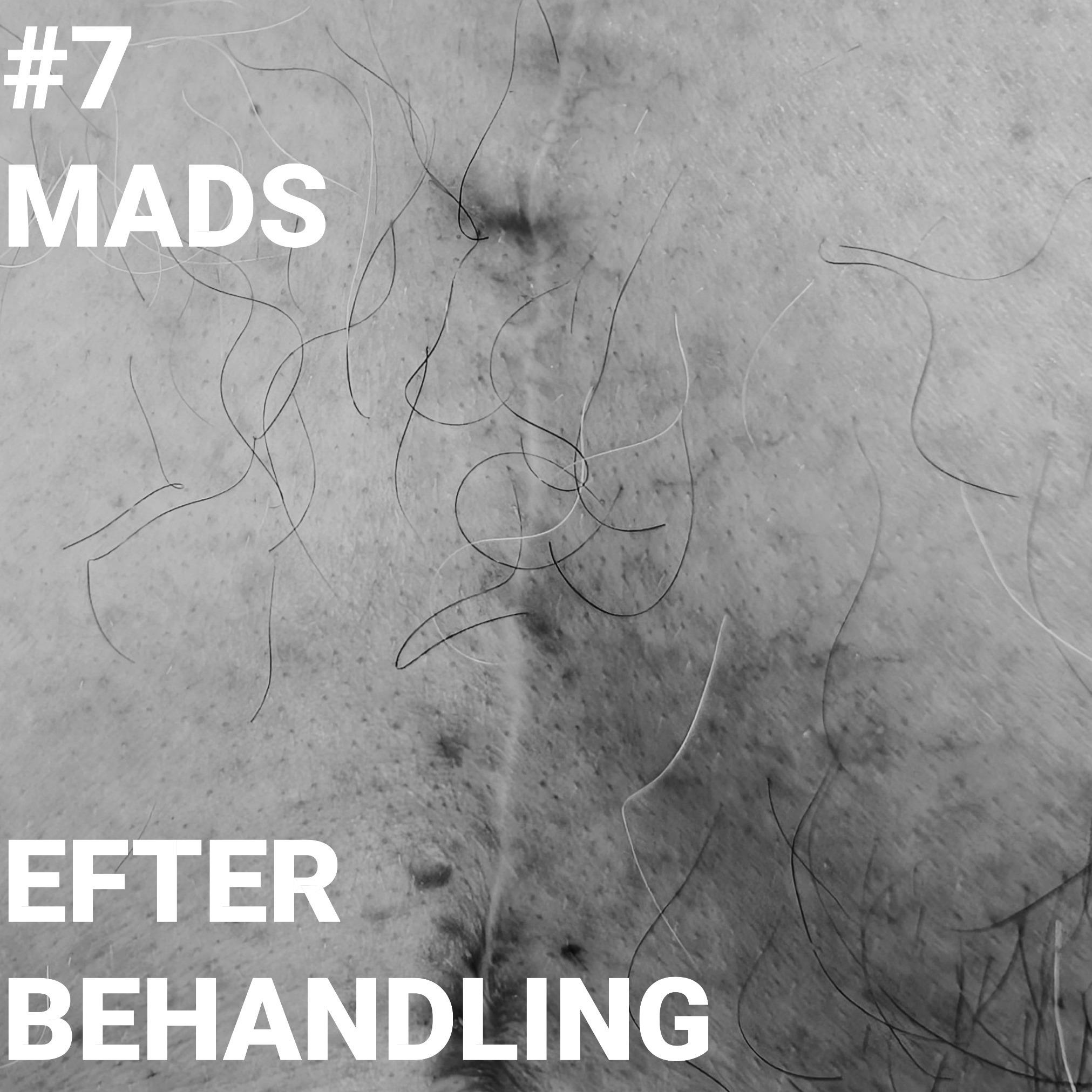 https://pbcdn1.podbean.com/imglogo/ep-logo/pbblog20398854/Mads_Kvadrat_med_tekst_lilleadrm8.jpg